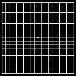 The Amsler Grid within the visual field; drawing photocopied with